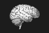 Hacking Dyslexia, ADHD, Neurodivergent Challenges