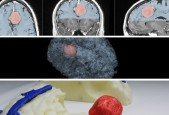 Medical Imaging, 3D Modelling and 3D Printing Beginners
